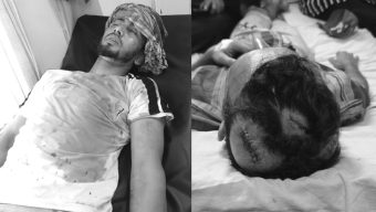 প্রতিপক্ষের হামলায় গুরুতর আহত আকবার আলীকে উন্নত চিকিৎসার জন্য ঢাকায় প্রেরণ